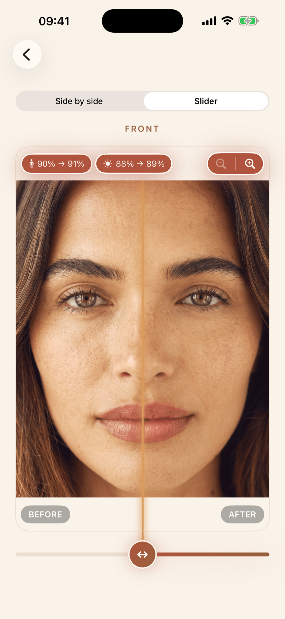 Ruyana before and after comparison slider